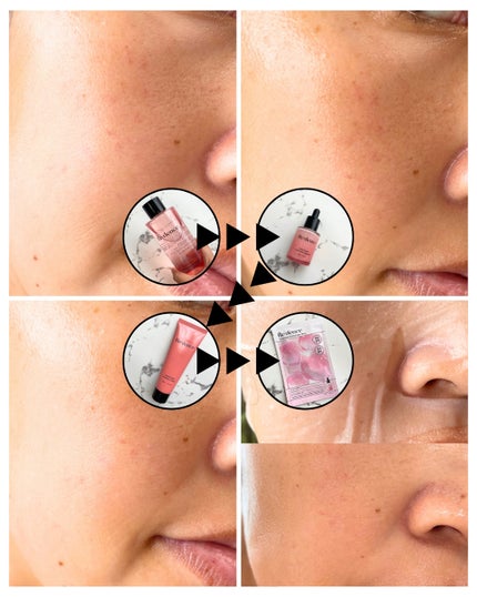 リデンス チェリートーン&スポットコレクターアンプル/redence/美容液を使ったクチコミ(4枚目)