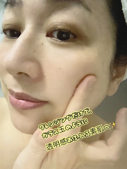 プレミアムもちソープ「グリーン」 /アレンシア/その他洗顔料を使ったクチコミ(6枚目)