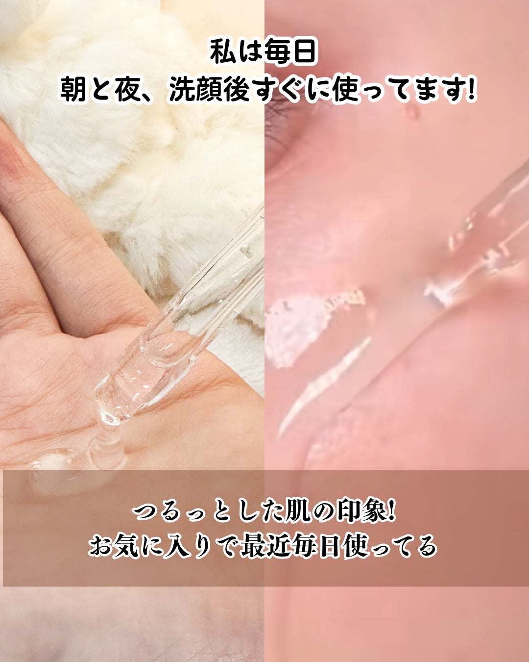 アネトス アクネケア トリートメント セラム/Anetos/美容液を使ったクチコミ(4枚目)