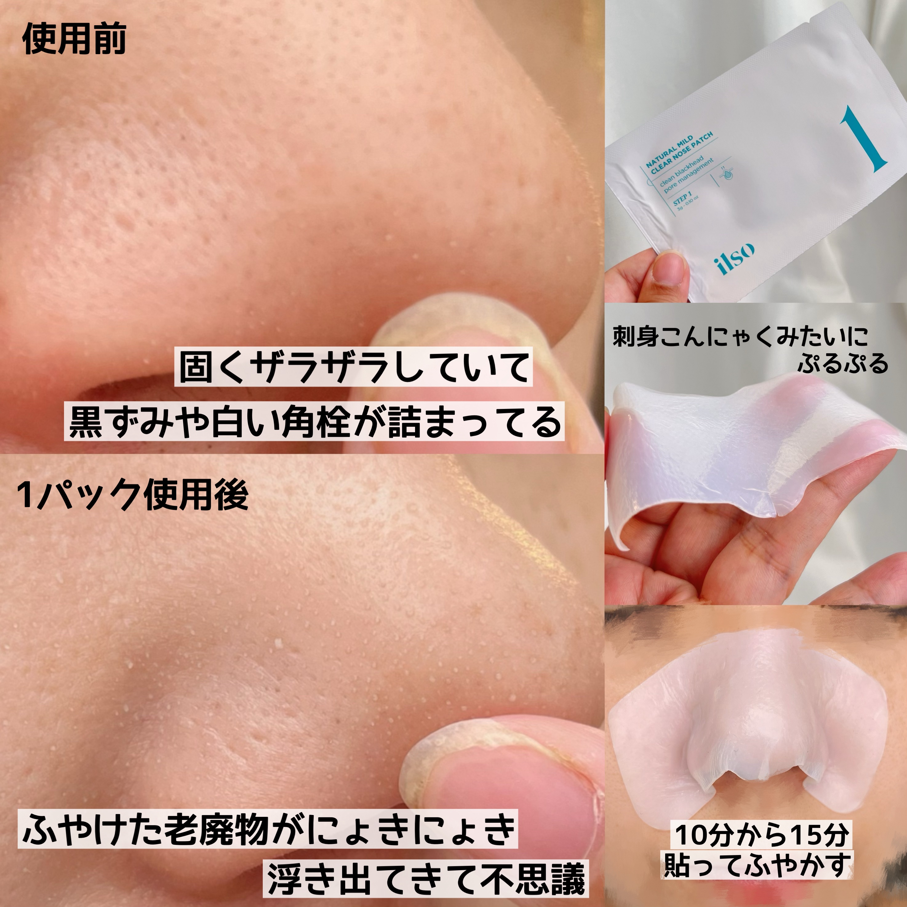 ナチュラルマイルドクリアノーズパック/ilso/シートマスク・パックを使ったクチコミ（3枚目）