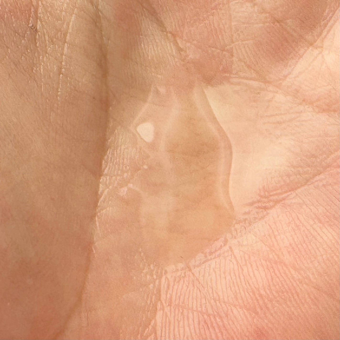 ケアナボーテ VC10 濃美容液/ケアナボーテ/美容液を使ったクチコミ(2枚目)