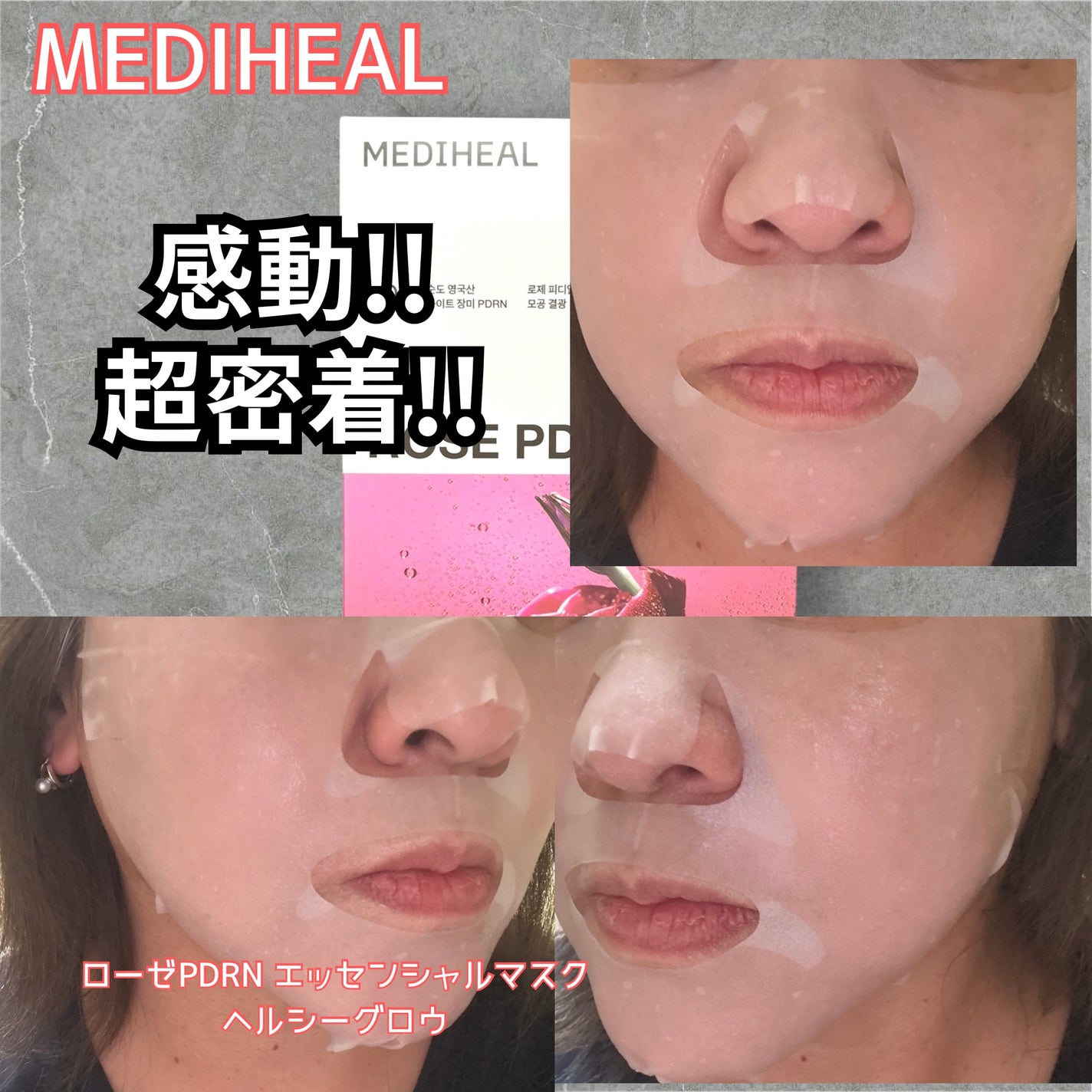 ローゼPDRNエッセンシャルマスクヘルシーグロウ/MEDIHEAL/シートマスク・パックを使ったクチコミ(4枚目)
