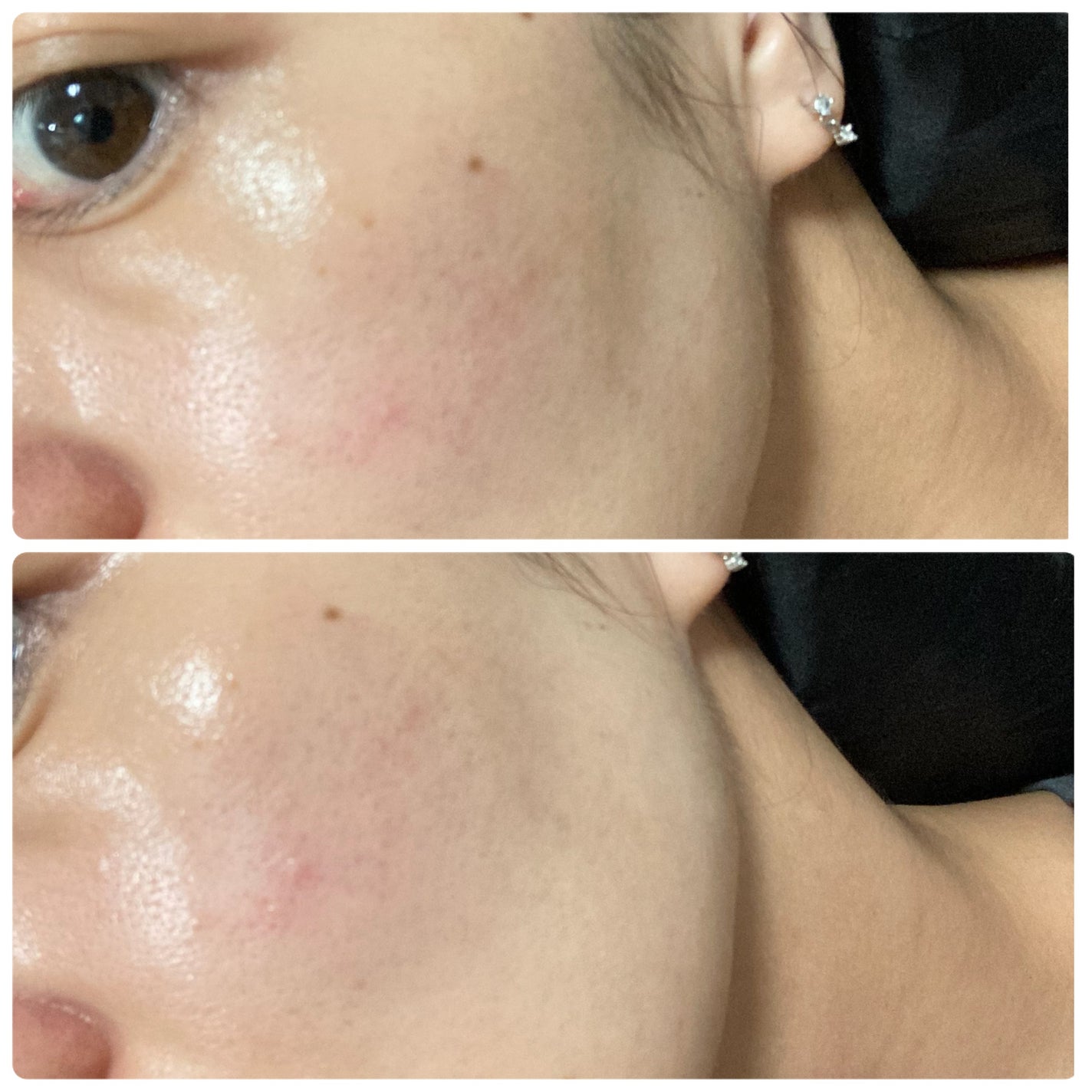 PHセンシティブアンプル/SAM'U/美容液を使ったクチコミ(4枚目)