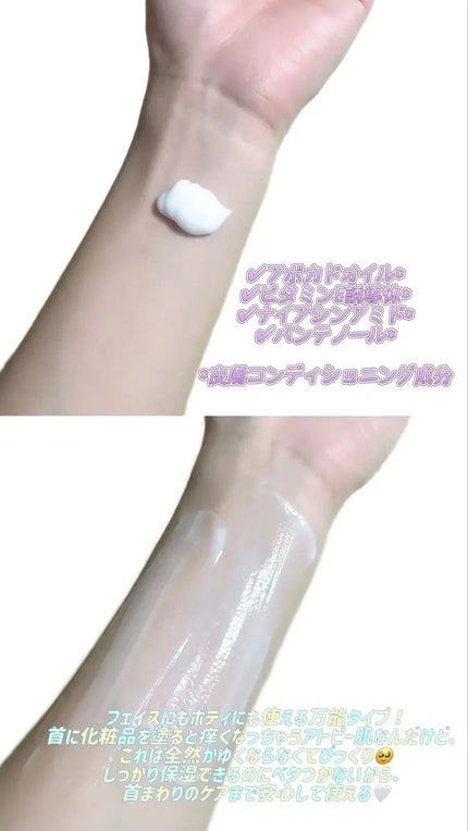 セタフィル モイスチャライジングローション/セタフィル/ボディローションを使ったクチコミ(2枚目)