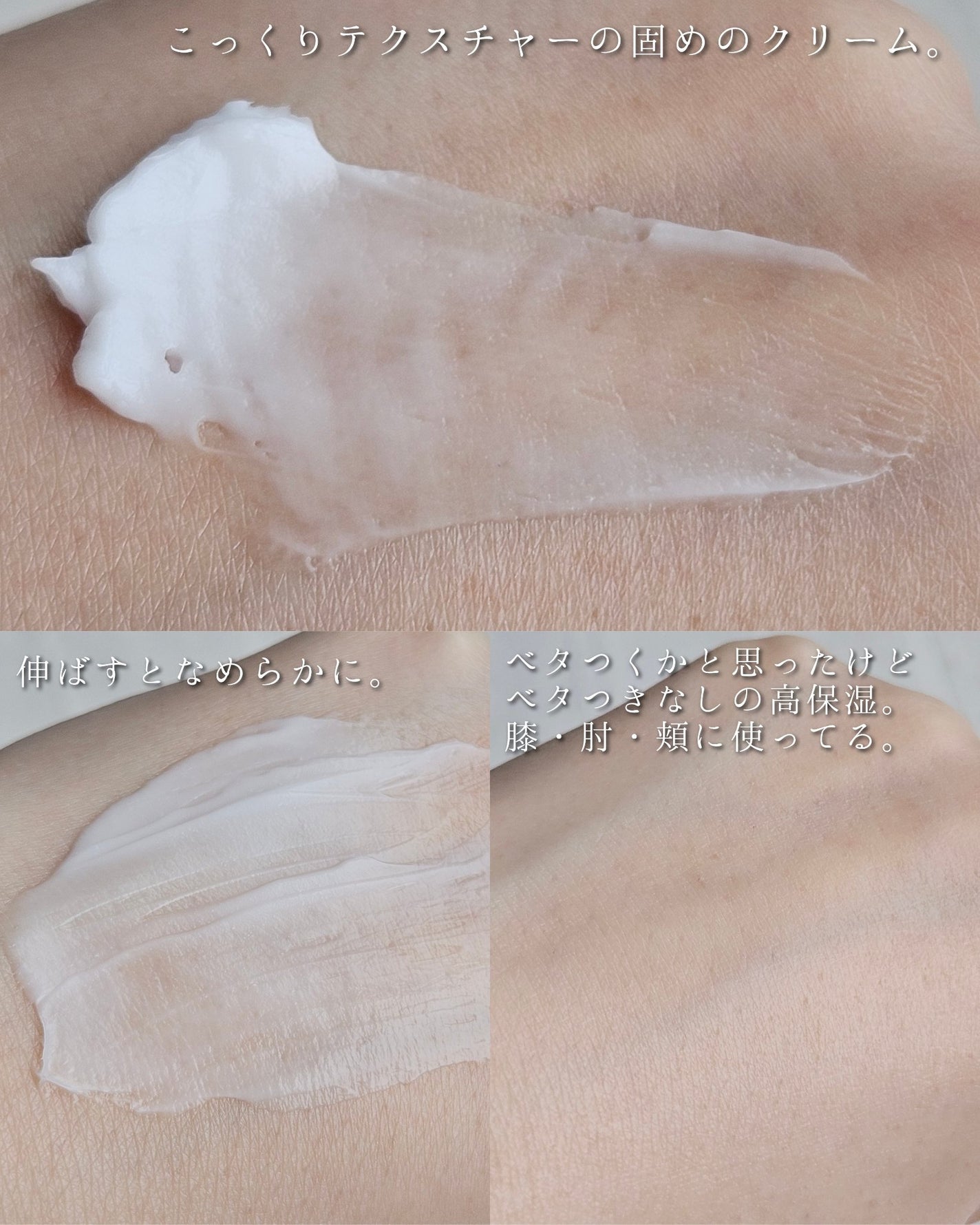 モイスチャライジング クリーム/セタフィル/ボディクリームを使ったクチコミ(3枚目)