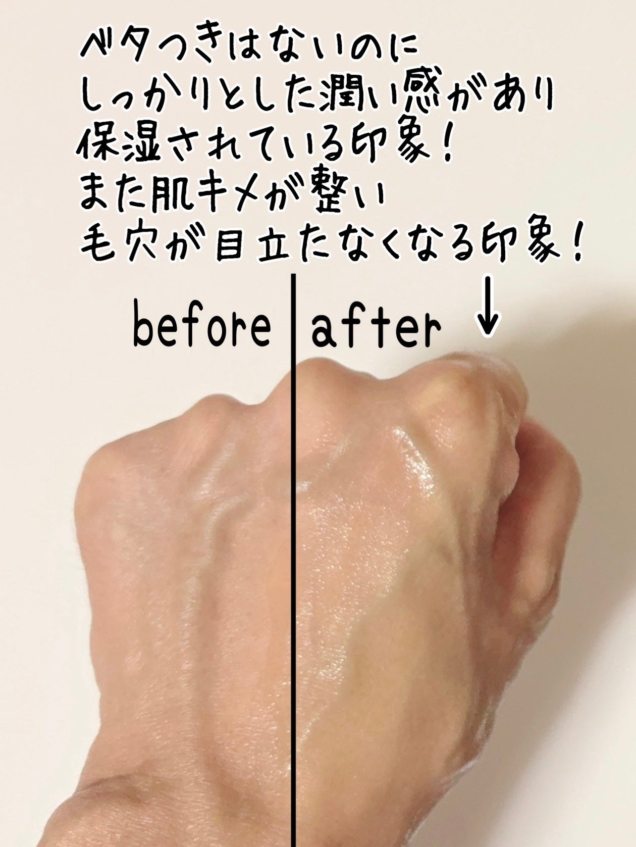 PDRN リバイタラジングアンプル/COSNORI/美容液を使ったクチコミ(5枚目)