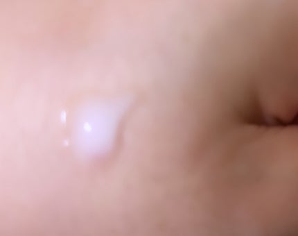 プロバイオシカ インテンシブ アンプル/SKIN1004/美容液を使ったクチコミ(2枚目)