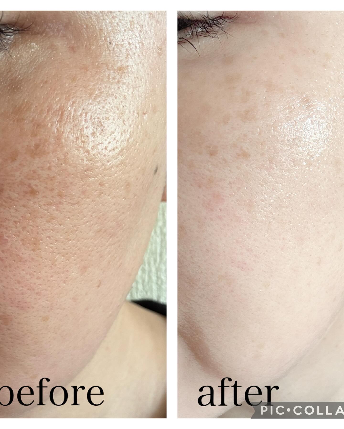 ヒソップモチパック/アレンシア/洗い流すパック・マスクを使ったクチコミ（3枚目）