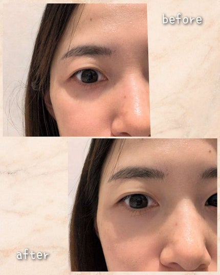 Eye kutto/メザイク/二重まぶた用アイテムを使ったクチコミ(6枚目)