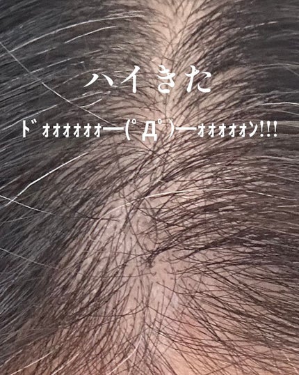 アデノバイタル スカルプ パワーショット/サブリミック/頭皮ローションを使ったクチコミ(6枚目)