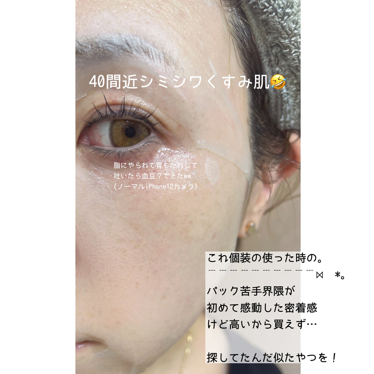 PDRNヒアルロン酸 カプセル100セラムマスクパック/Anua/シートマスク・パックを使ったクチコミ(4枚目)