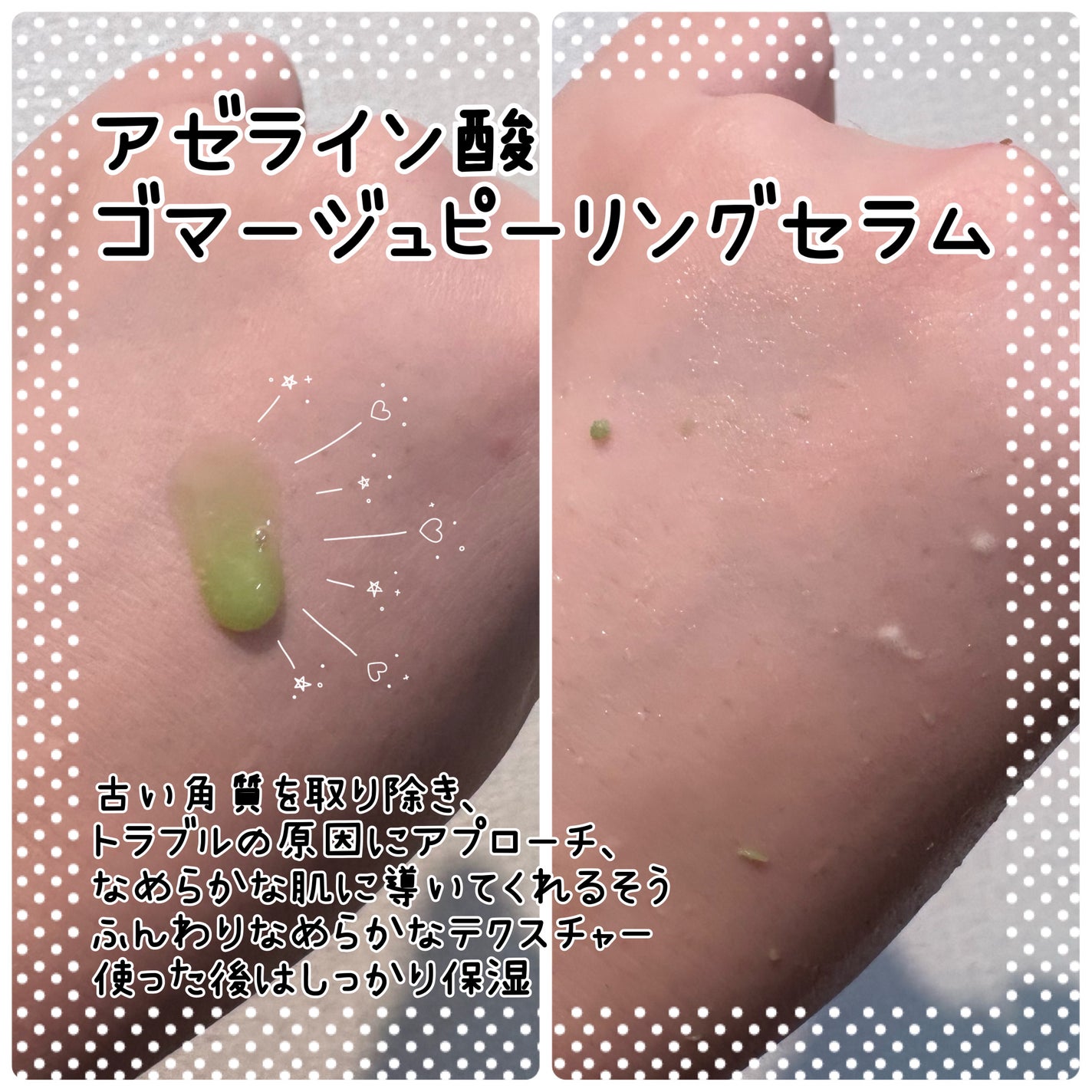 アゼライン酸ゴマージュピーリングセラム/Dr.Melaxin/美容液を使ったクチコミ(2枚目)