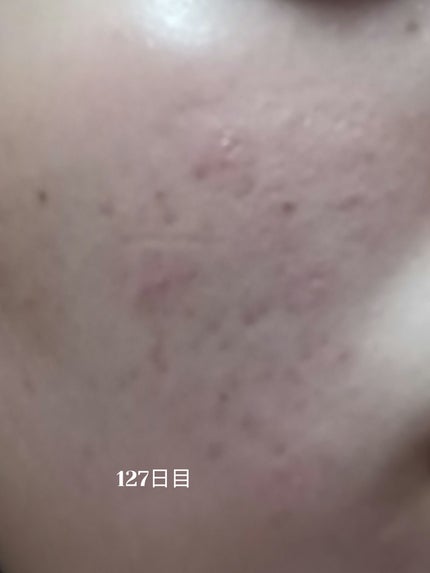 ã䜿ã£ãã¯ãã³ãïŒ1æç®ïŒ