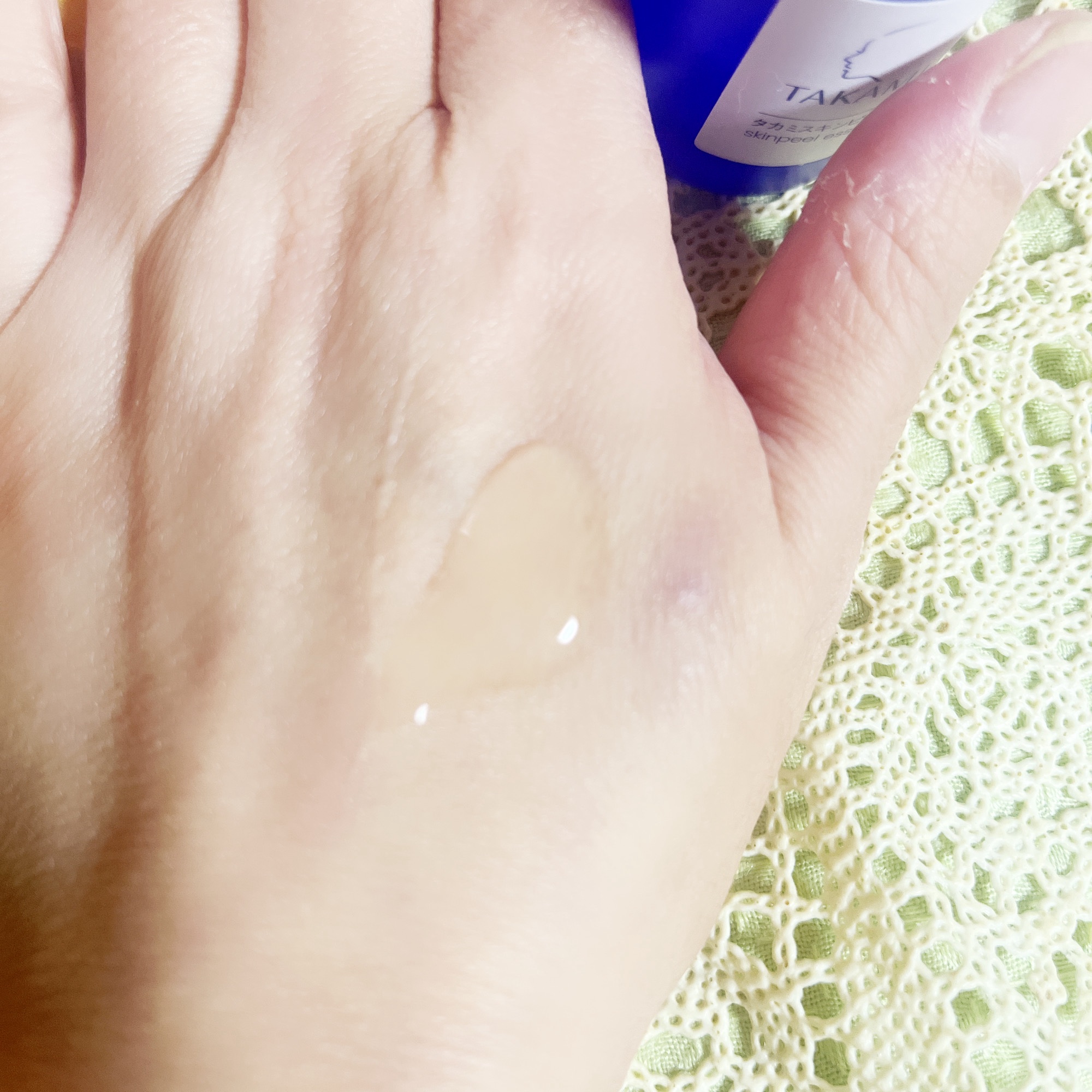 タカミスキンピール/タカミ/ブースター・導入液を使ったクチコミ（3枚目）