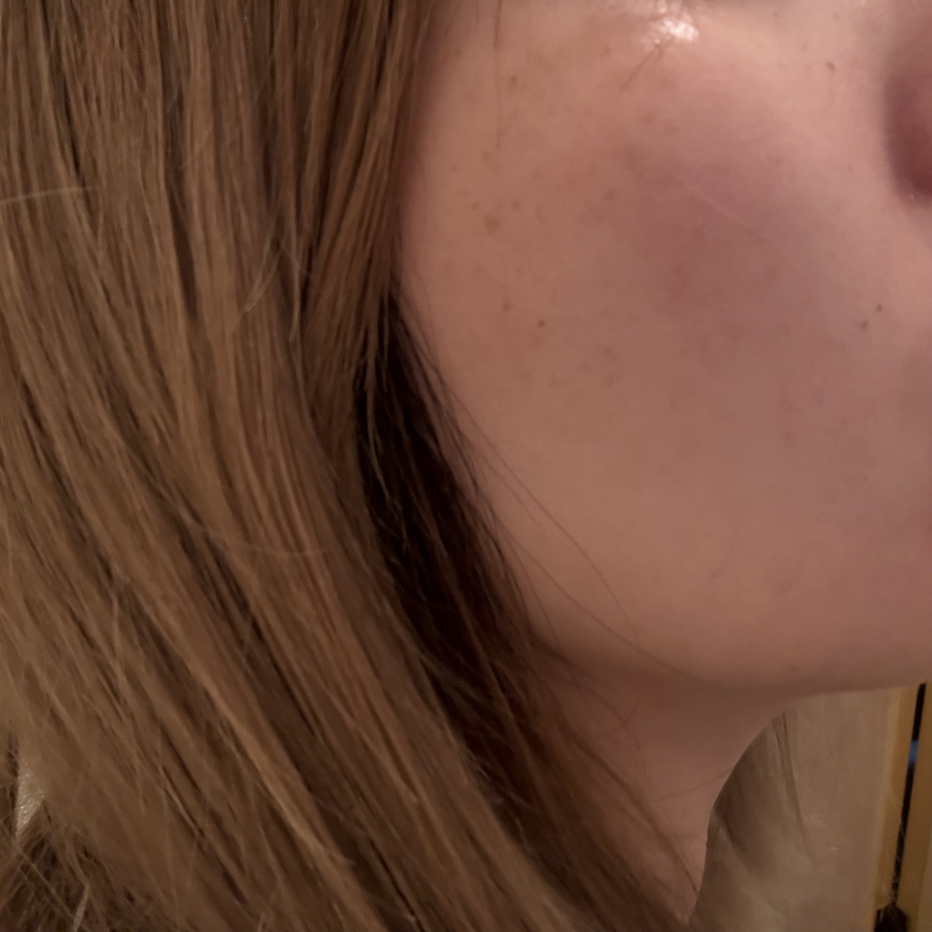 復活草ビフィダセラムファーミングドロップ/Abib /美容液を使ったクチコミ（3枚目）