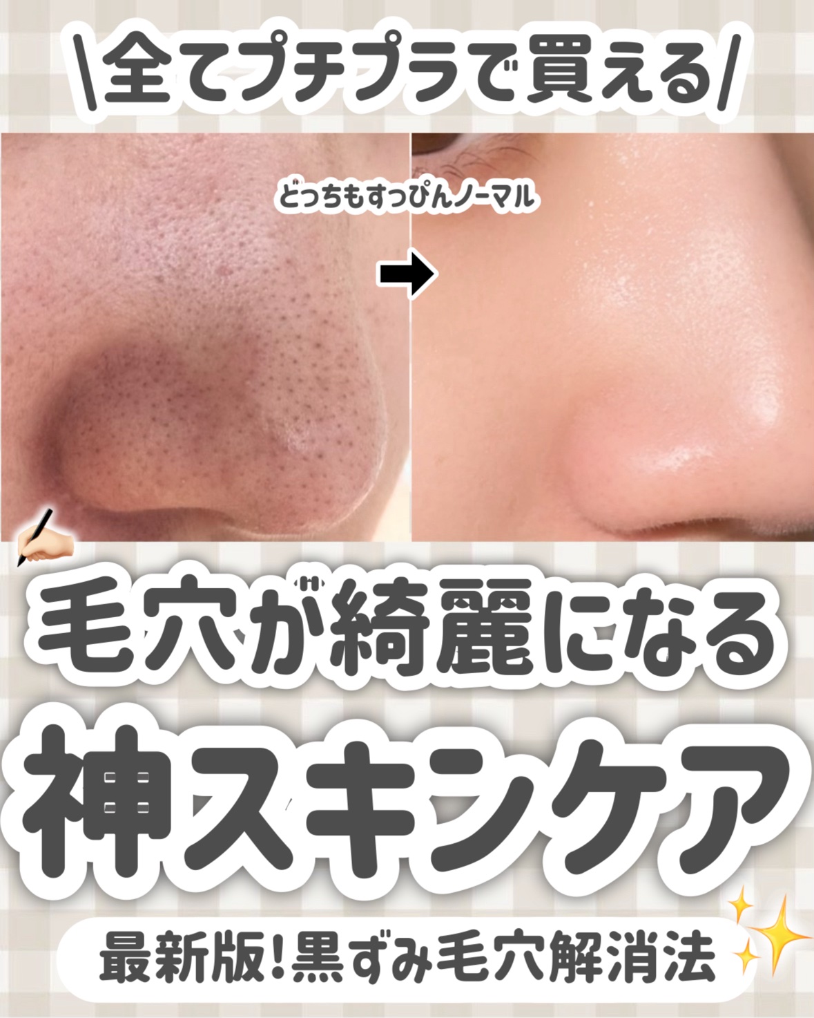 ロゼットゴマージュ/ロゼット/ピーリングを使ったクチコミ（1枚目）