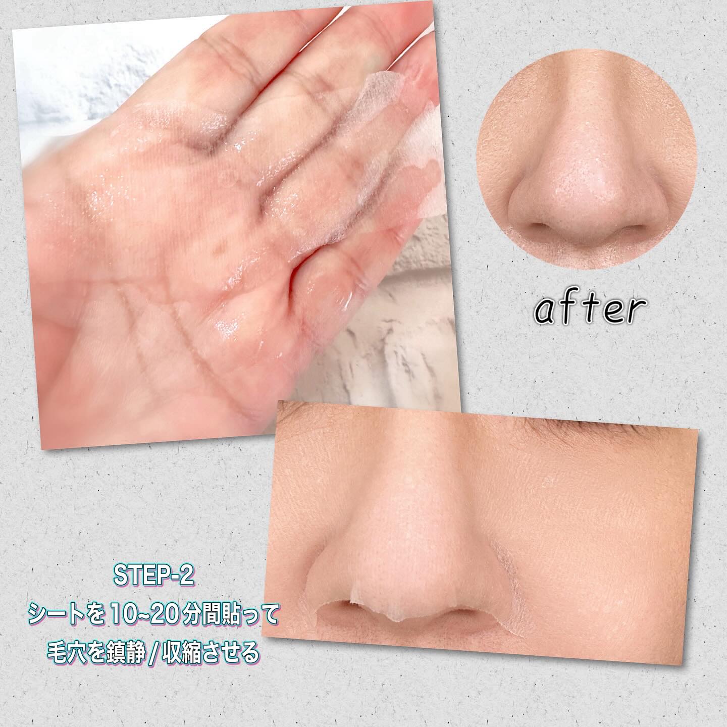 ナチュラルマイルドクリアノーズパック/ilso/シートマスク・パックを使ったクチコミ（3枚目）