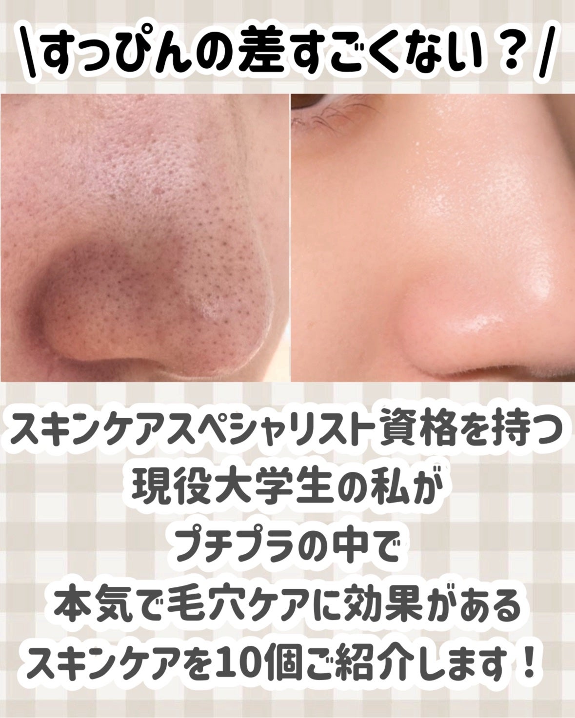 ロゼットゴマージュ/ロゼット/ピーリングを使ったクチコミ(2枚目)