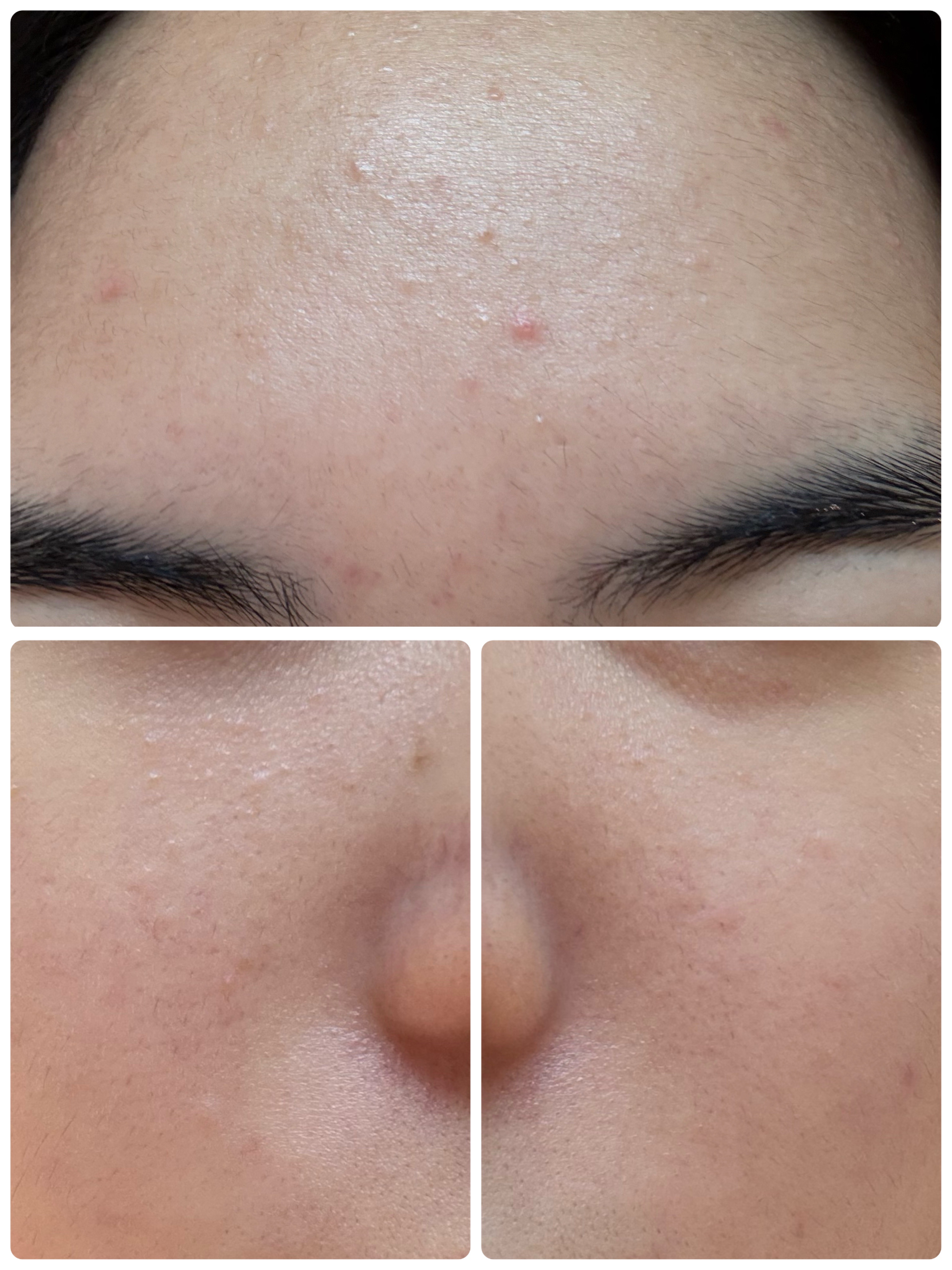 GLAM UP炭酸泡クレイマスク/GLAM UP/洗い流すパック・マスクを使ったクチコミ（3枚目）