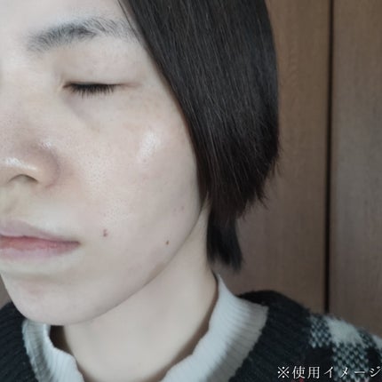 アトバリア365クリーム/AESTURA/フェイスクリームを使ったクチコミ(5枚目)