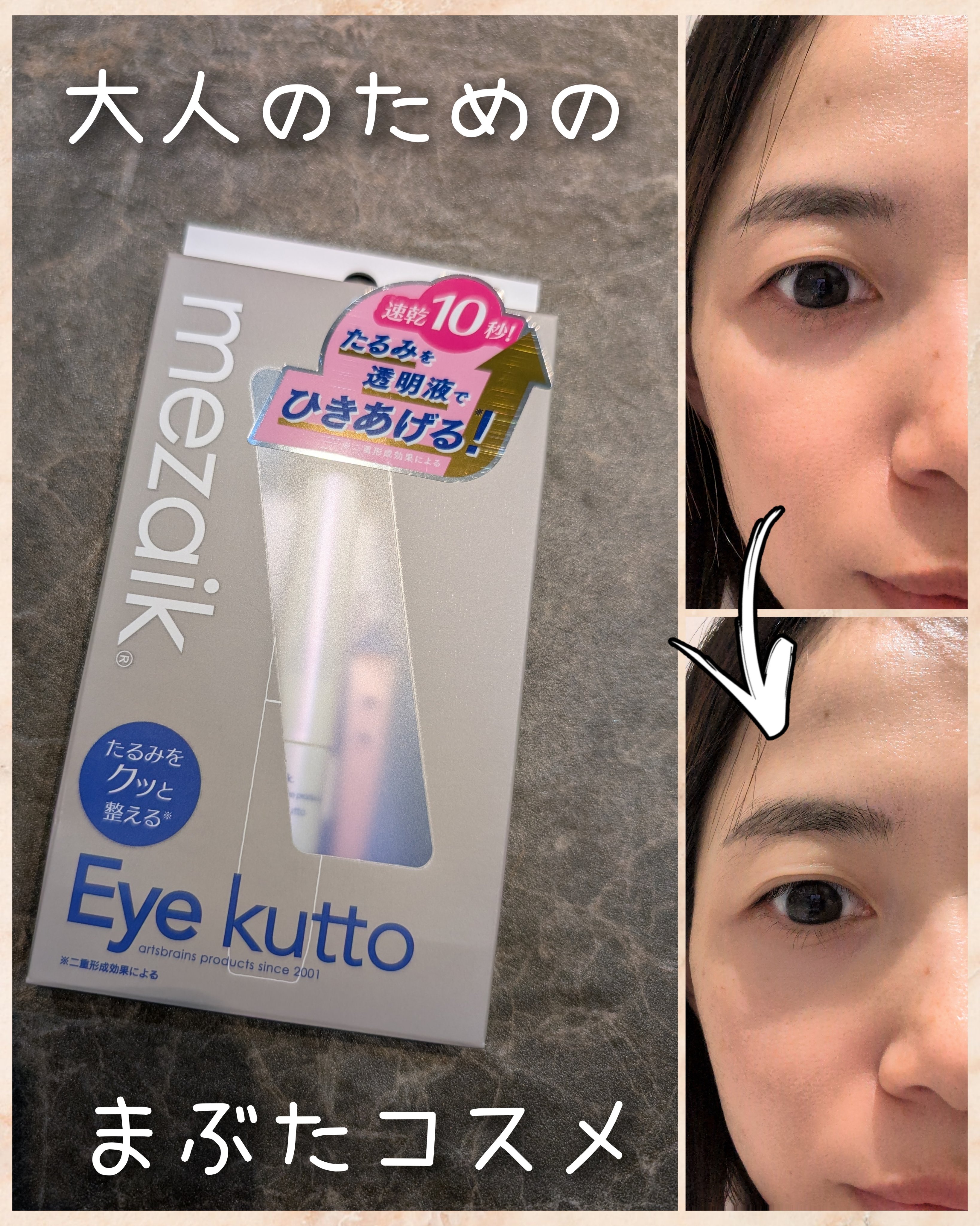 Eye kutto/メザイク/二重まぶた用アイテムを使ったクチコミ（1枚目）