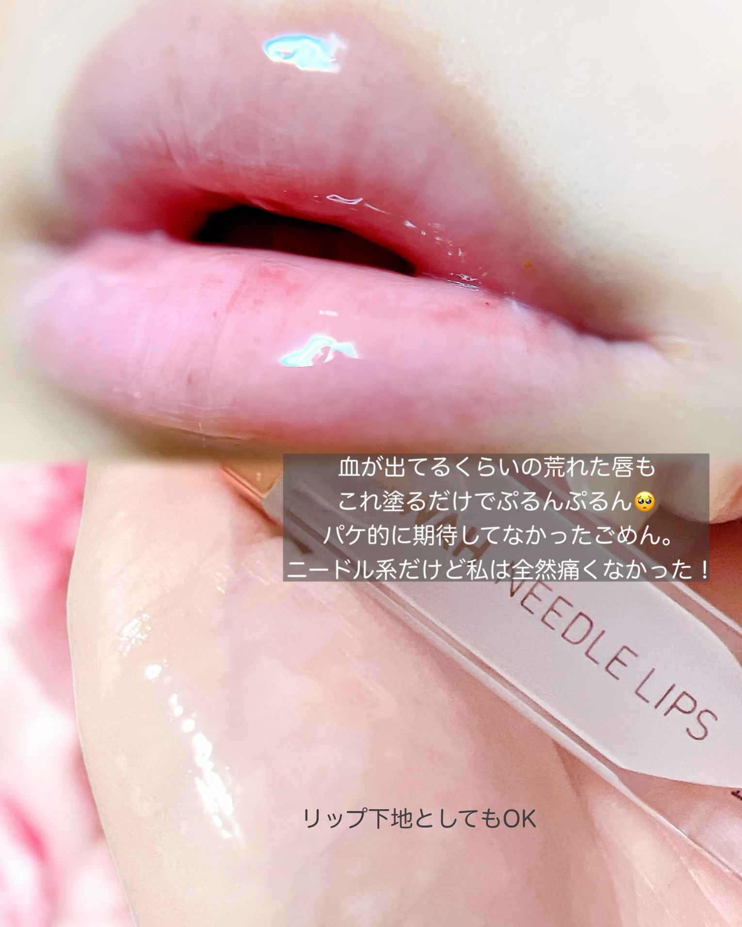 MWAH NEEDLE LIPS/MWAH/リッププランパーを使ったクチコミ（3枚目）