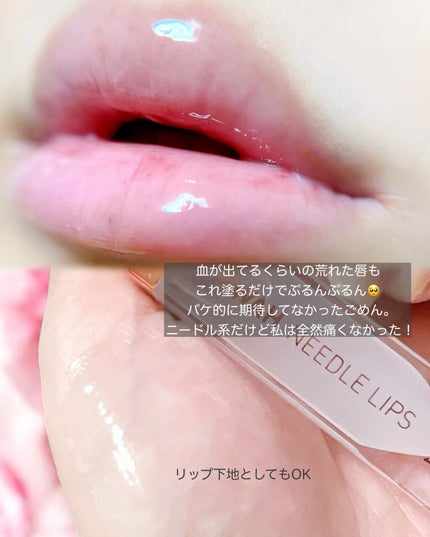 MWAH NEEDLE LIPS/MWAH/リッププランパーを使ったクチコミ(3枚目)