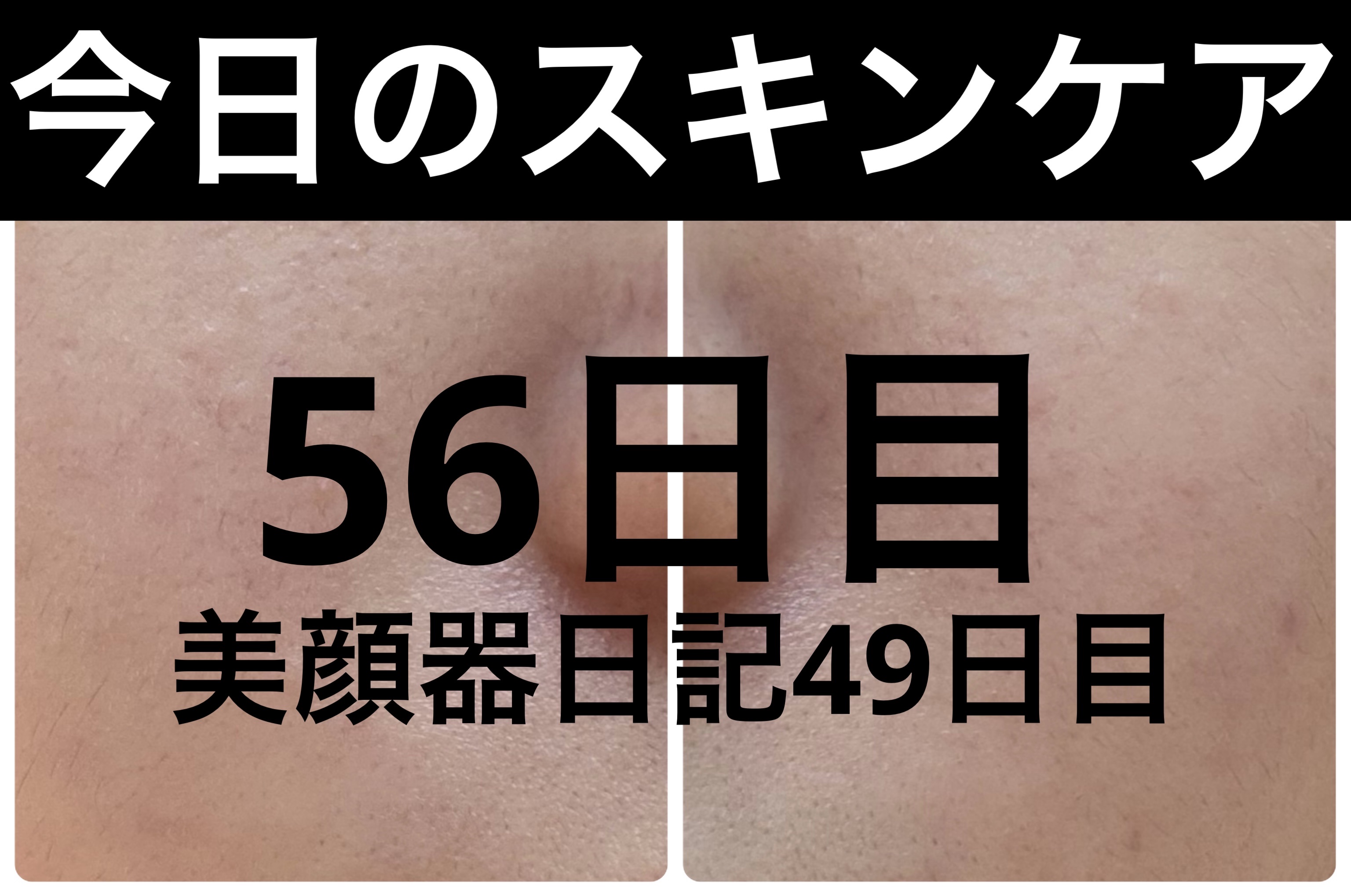 GLAM UP炭酸泡クレイマスク/GLAM UP/洗い流すパック・マスクを使ったクチコミ（1枚目）