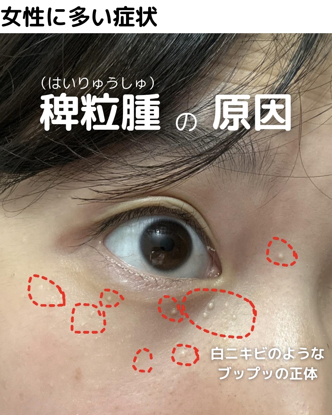 アネトス マイルド フェイシャル クレンザー/Anetos/洗顔フォームを使ったクチコミ（1枚目）