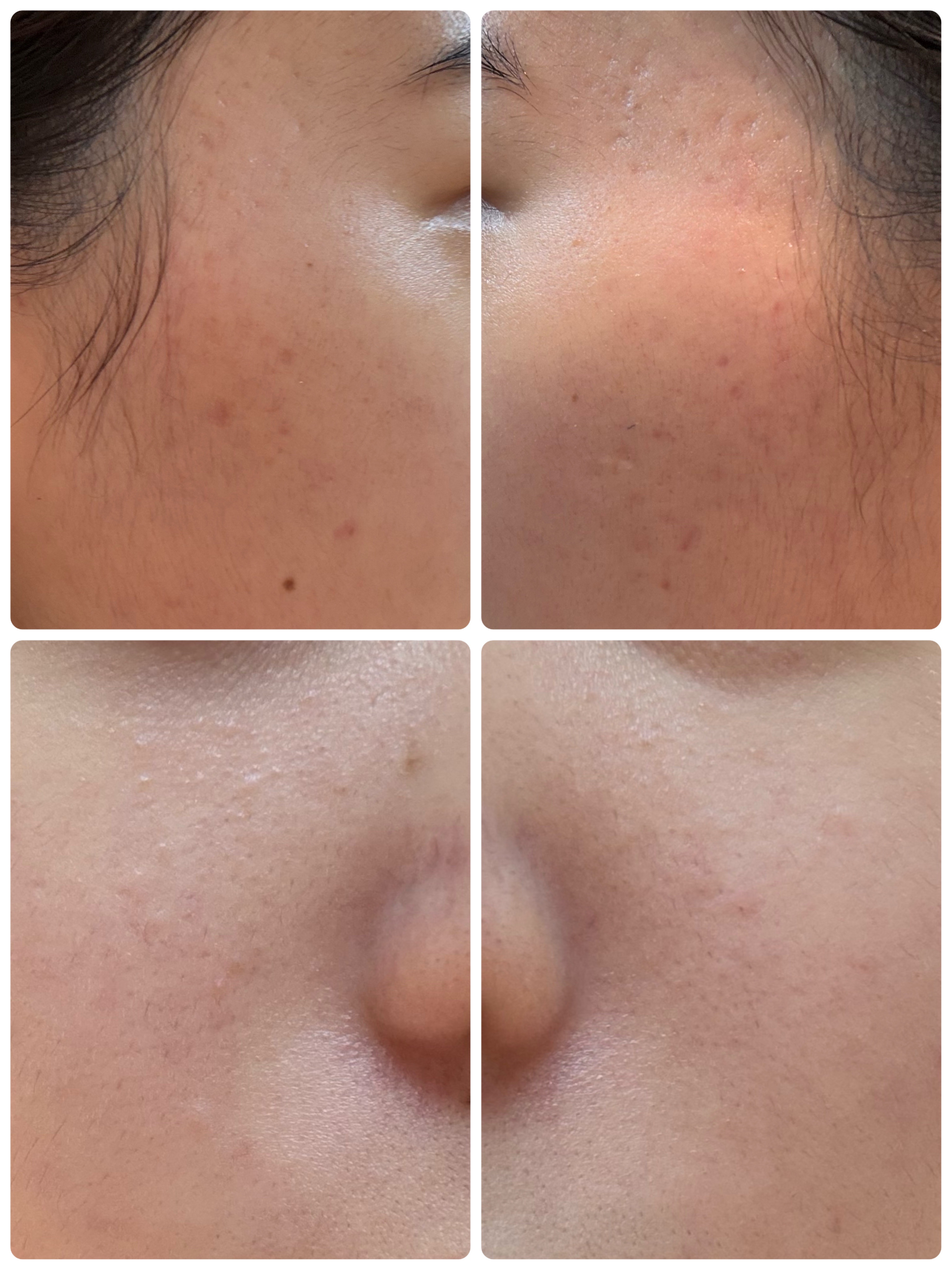 GLAM UP炭酸泡クレイマスク/GLAM UP/洗い流すパック・マスクを使ったクチコミ（2枚目）