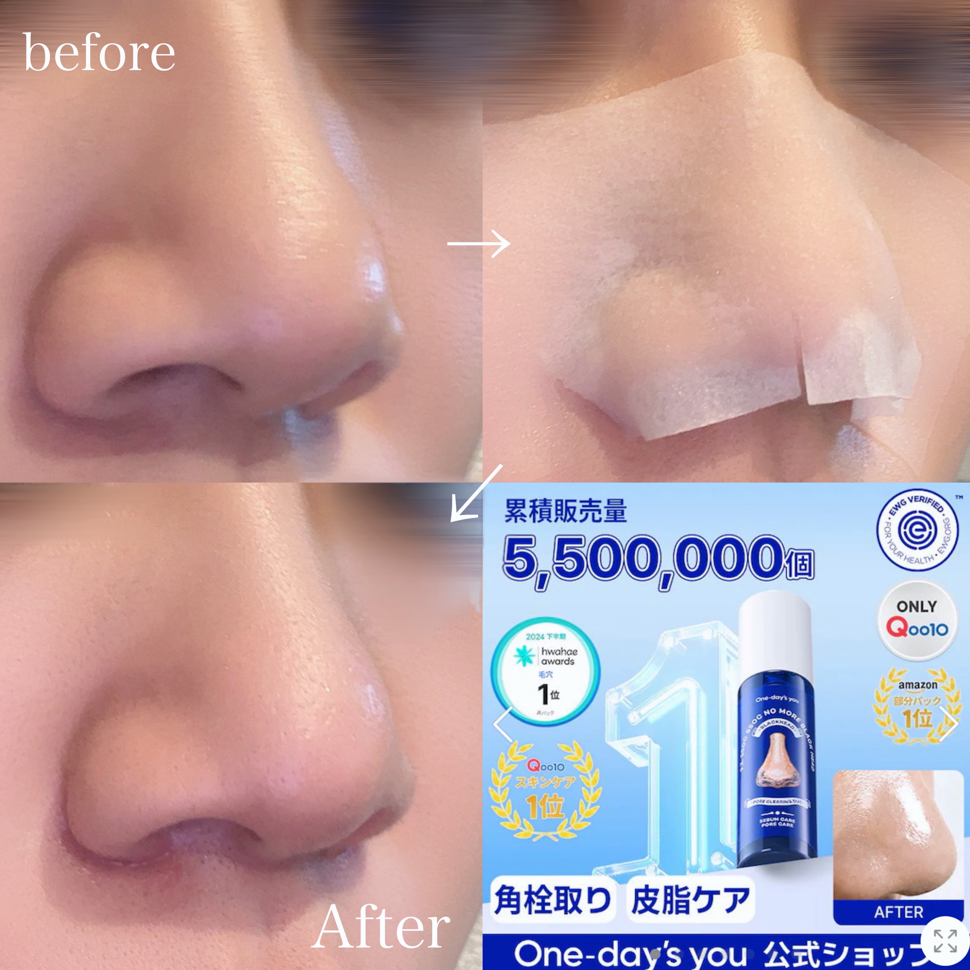 ノーモアブラックヘッド(ノーズピーリング)/One-day's you/スクラブ・ゴマージュを使ったクチコミ（3枚目）