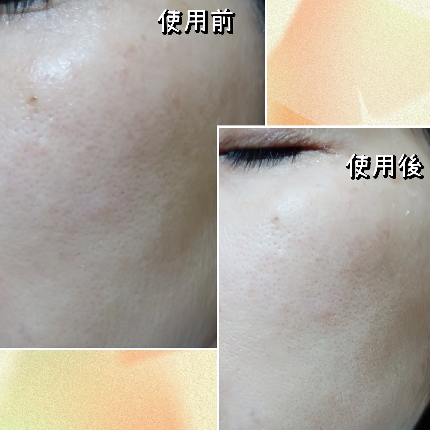 フィルミン/EPORASHE/洗い流すパック・マスクを使ったクチコミ(7枚目)