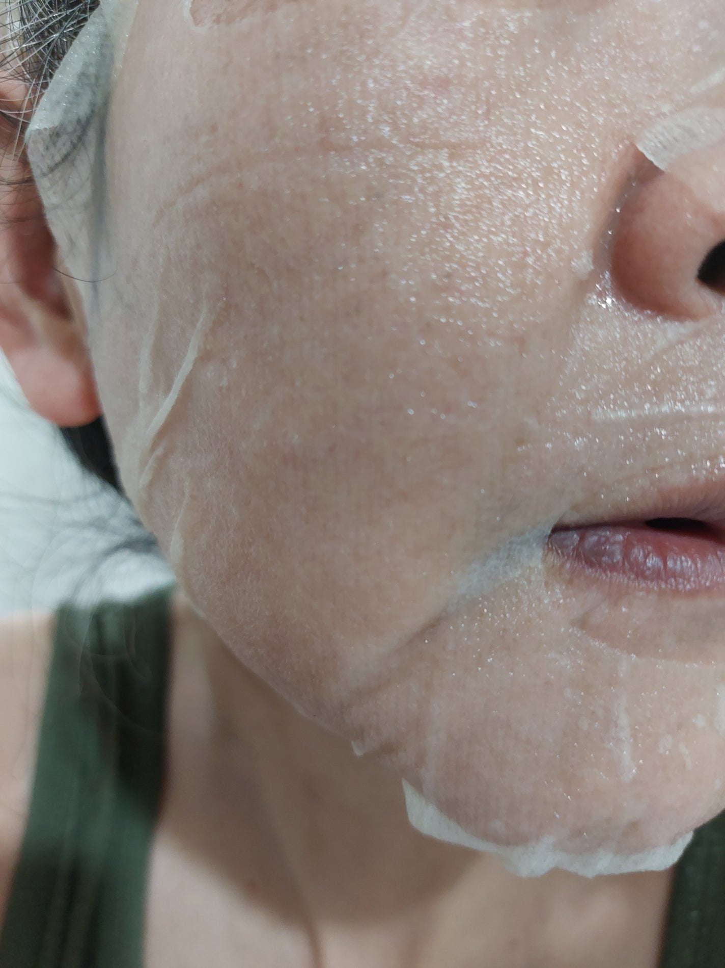 VC+3 Bright Banana Peel Mask/LIALUSTER/シートマスク・パックを使ったクチコミ(4枚目)