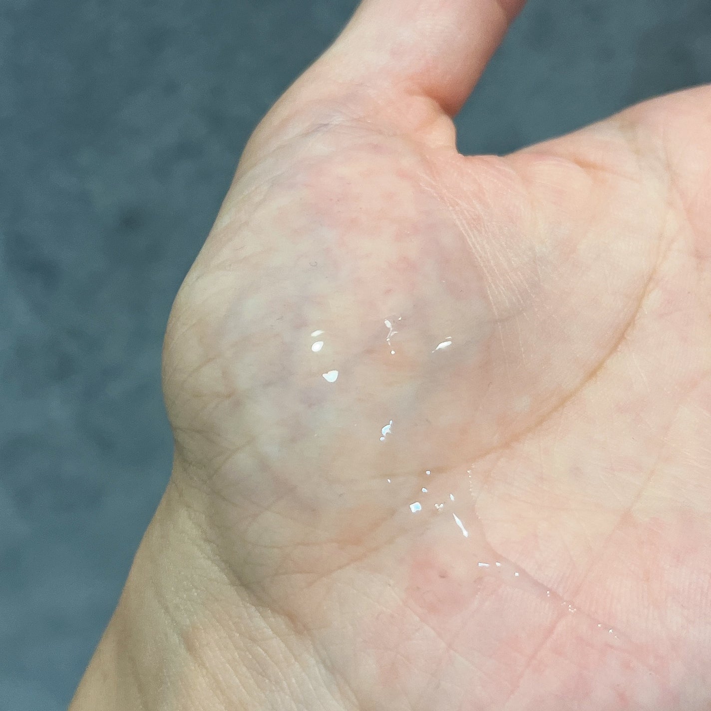 iPインフィニットエッセンスリフト/ミュゼコスメ/美容液を使ったクチコミ(4枚目)