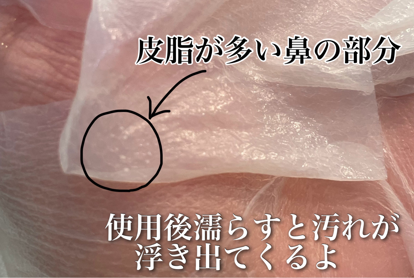 トラブルパッチマスク/EIOM/その他スキンケアを使ったクチコミ（3枚目）