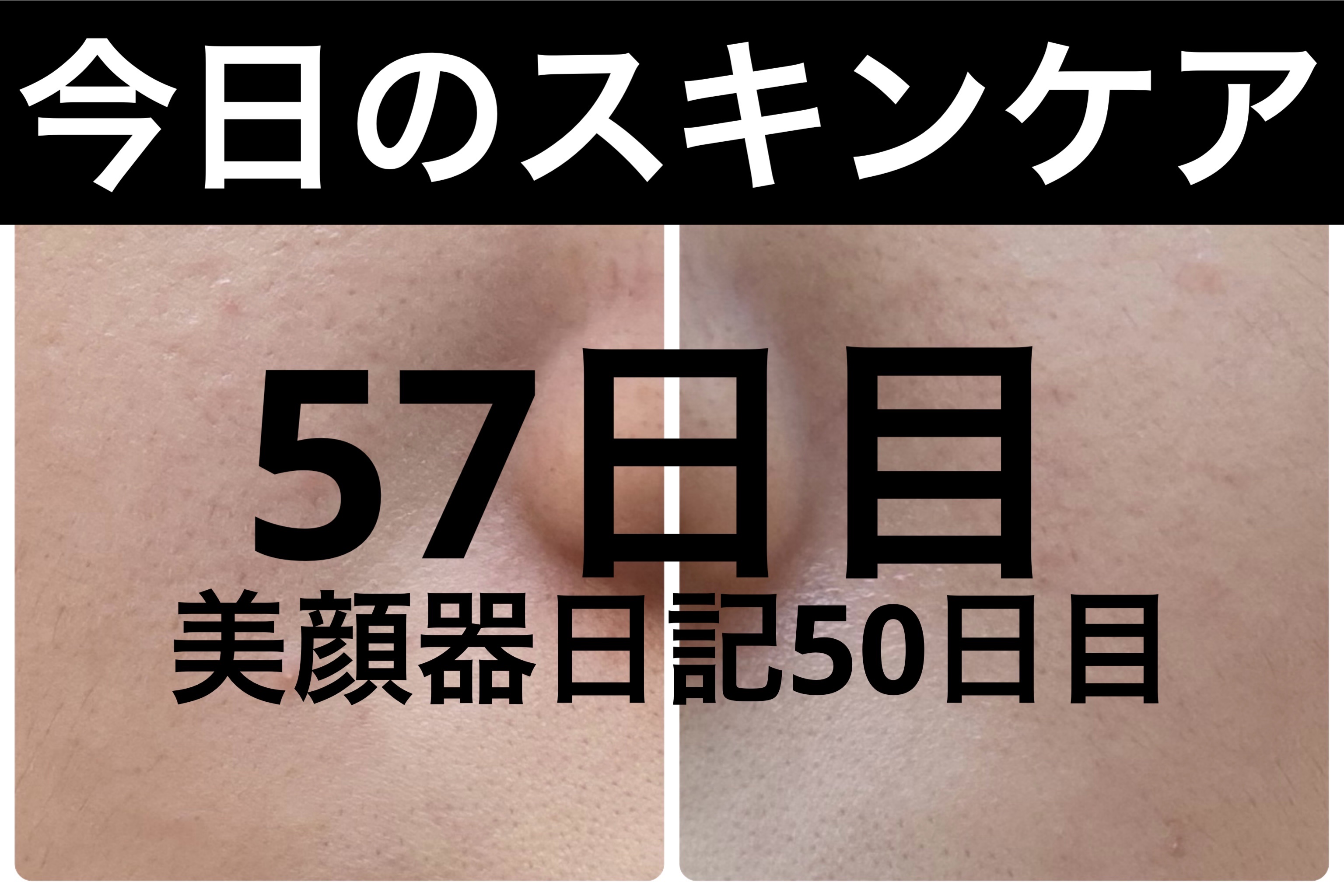 GLAM UP炭酸泡クレイマスク/GLAM UP/洗い流すパック・マスクを使ったクチコミ（1枚目）