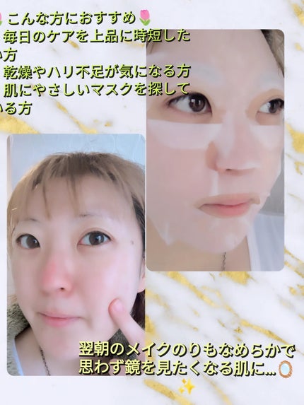潤エッティモイストマスク/安心健康ライフ/シートマスク・パックを使ったクチコミ(3枚目)