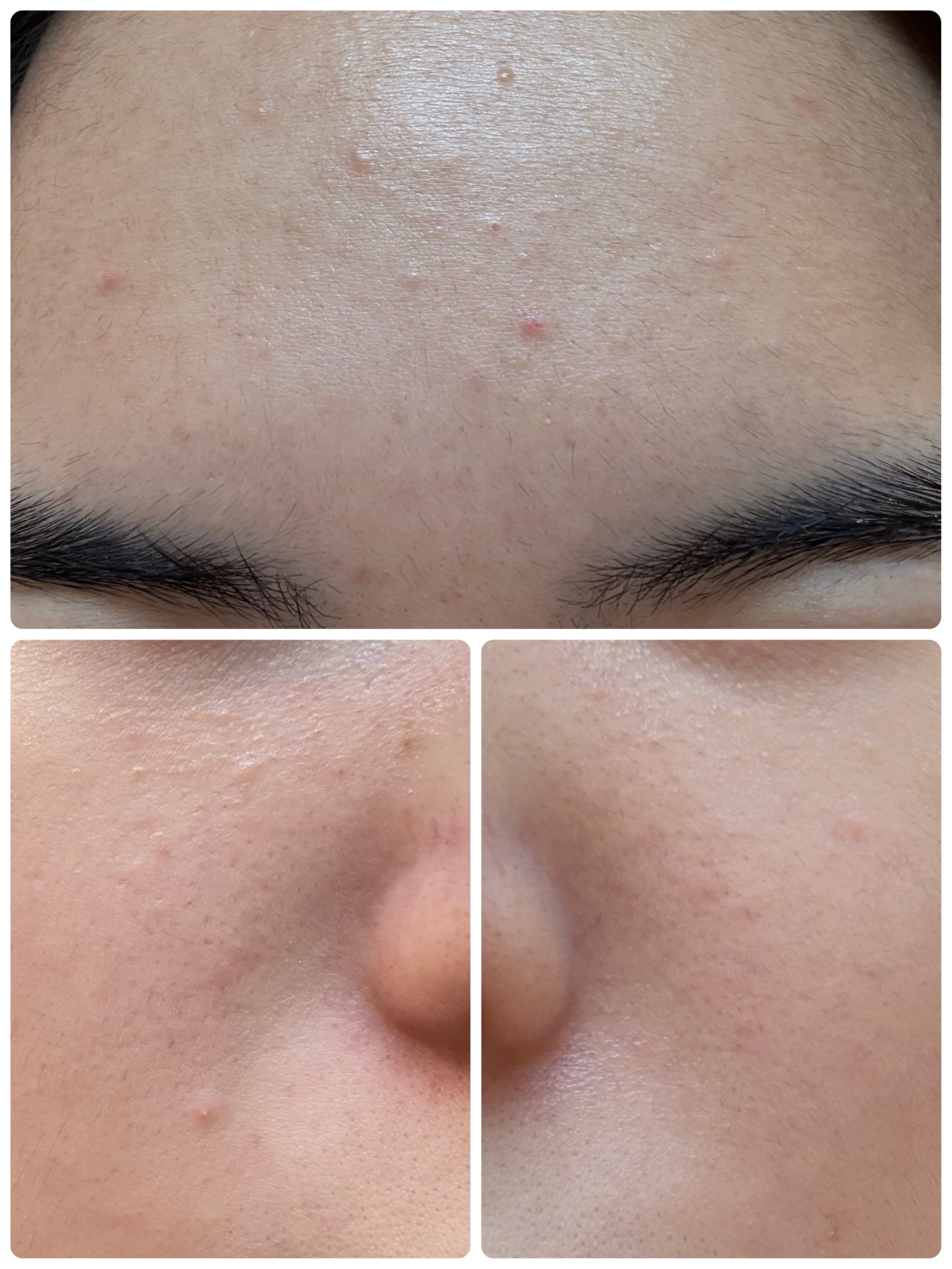 GLAM UP炭酸泡クレイマスク/GLAM UP/洗い流すパック・マスクを使ったクチコミ（3枚目）