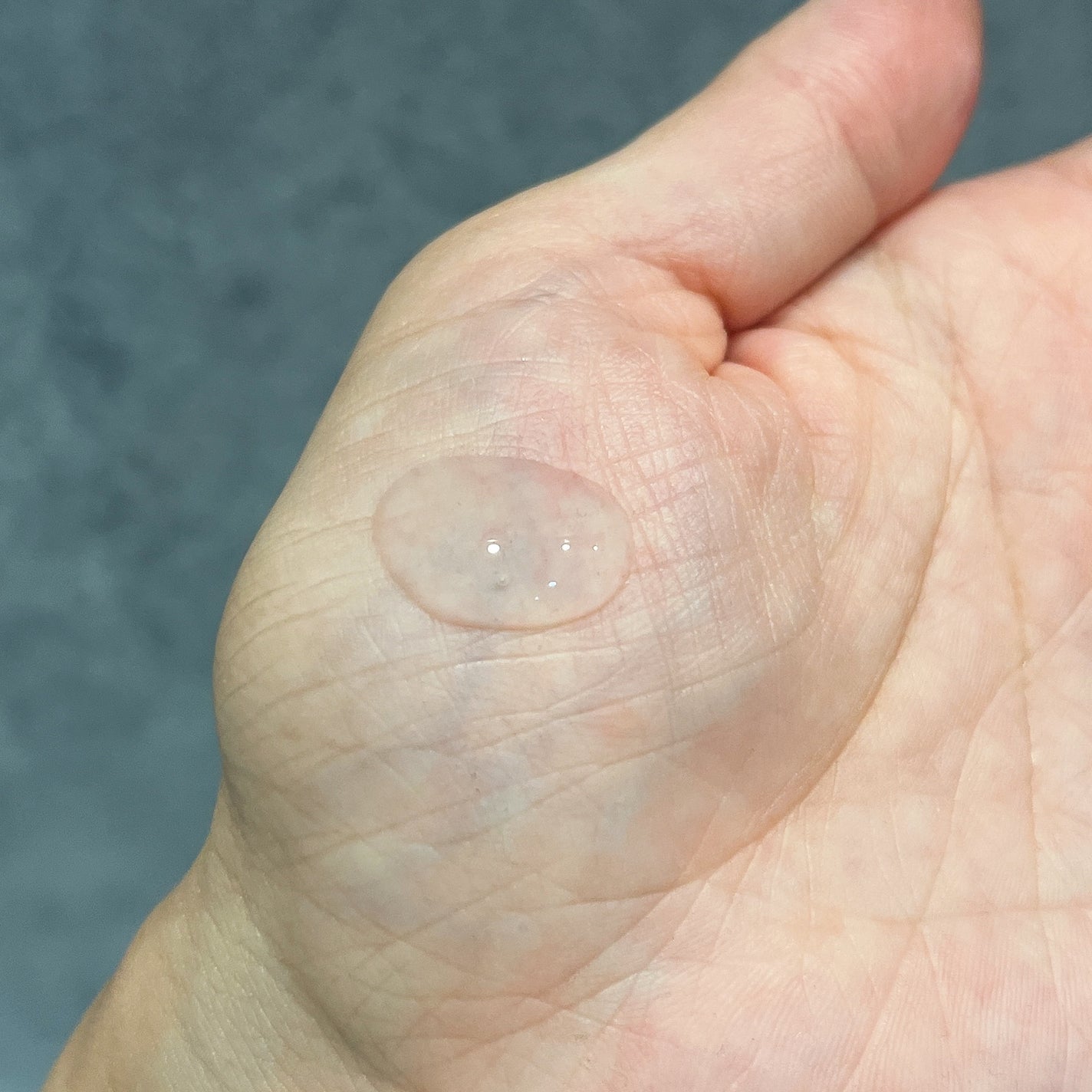 iPインフィニットエッセンスリフト/ミュゼコスメ/美容液を使ったクチコミ(3枚目)