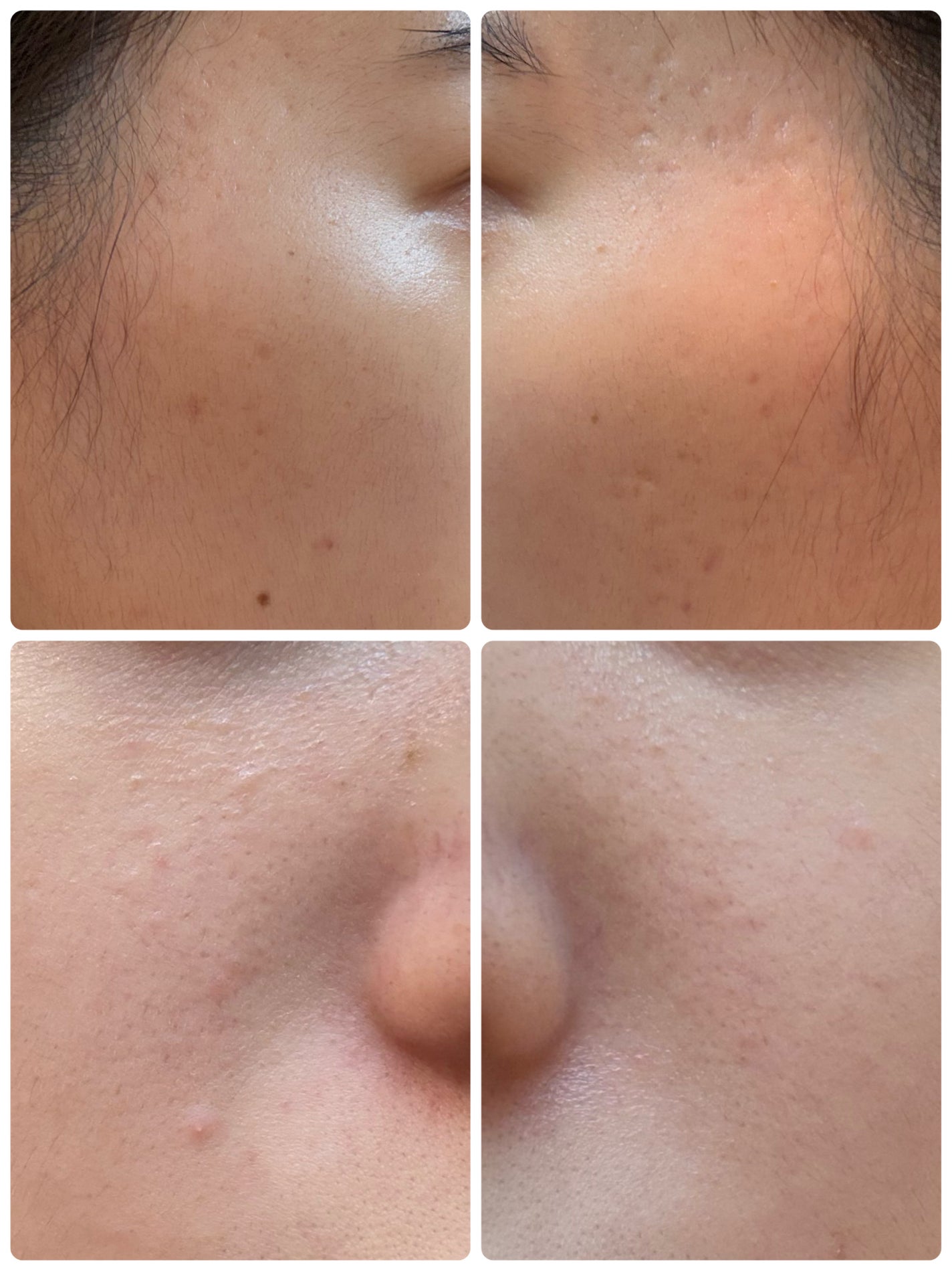 モーニングジェルウォッシュ/ビトレスキン/その他洗顔料を使ったクチコミ(2枚目)