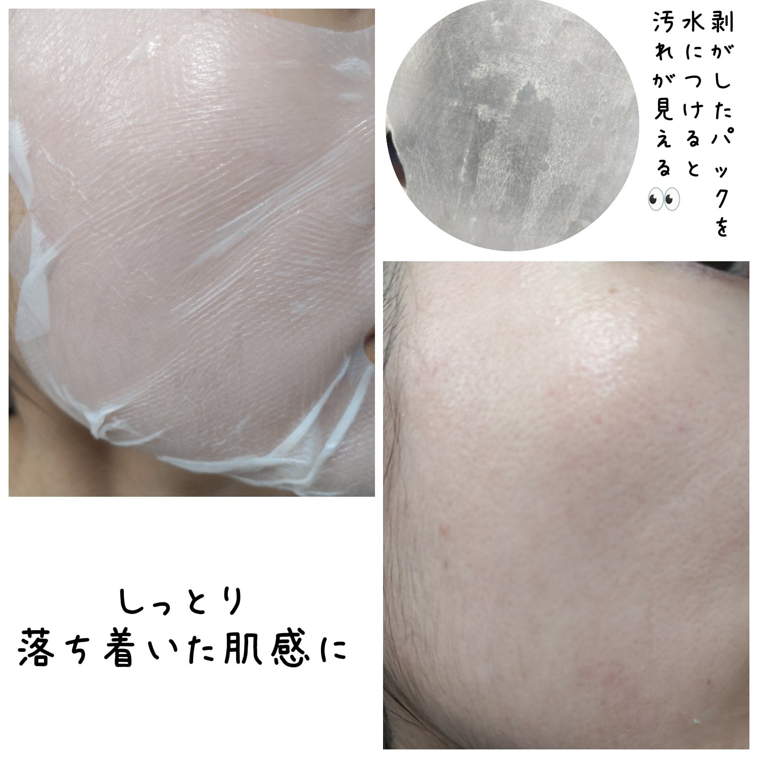 トラブルパッチマスク/EIOM/その他スキンケアを使ったクチコミ（3枚目）