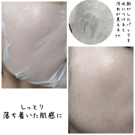 トラブルパッチマスク/EIOM/その他スキンケアを使ったクチコミ(3枚目)