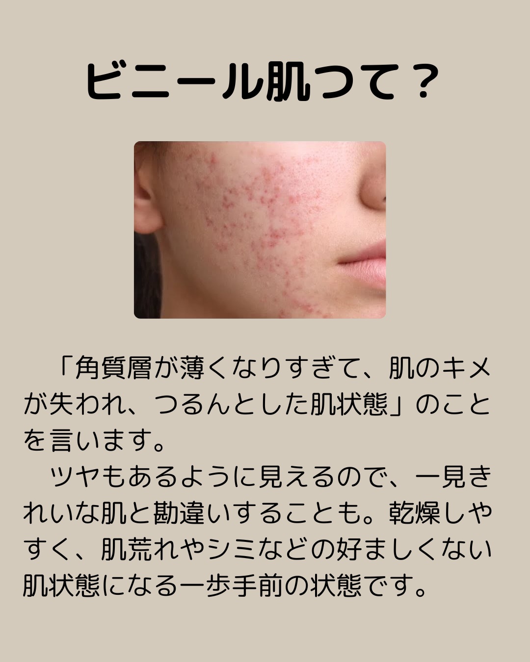 アネトス リフレッシング フェイシャル マイセラー クレンジング ウォーター /Anetos/クレンジングウォーターを使ったクチコミ（2枚目）