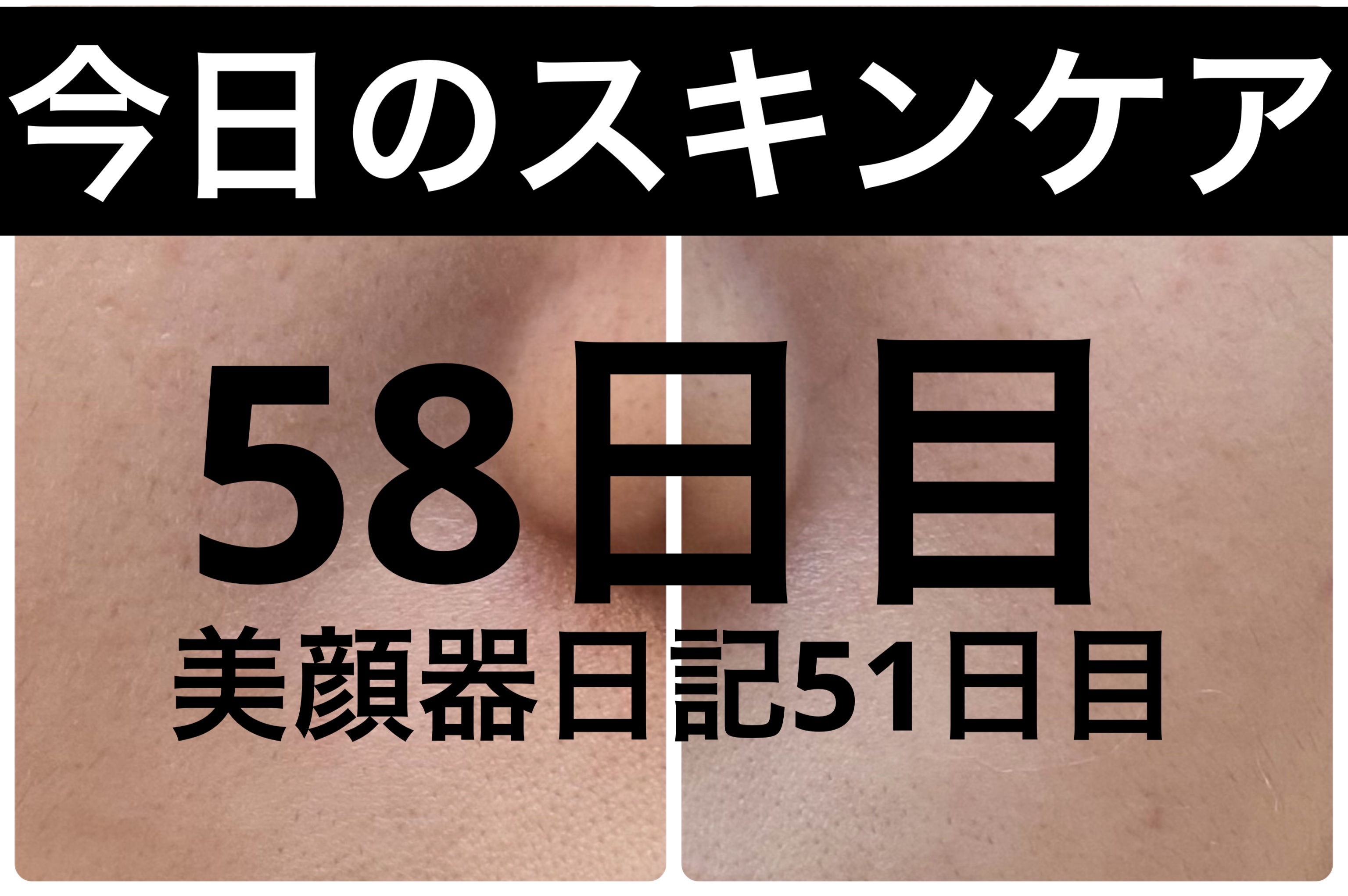 ブラックヘッドバームスクラブ/オブジェ/フェイスバームを使ったクチコミ（1枚目）