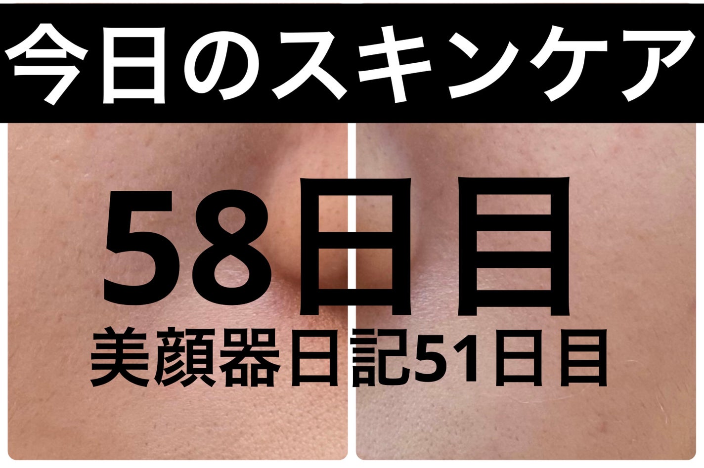 モーニングジェルウォッシュ/ビトレスキン/その他洗顔料を使ったクチコミ(1枚目)