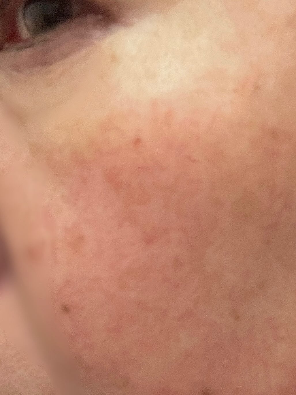 プレミアムもちソープグリーン/アレンシア/その他洗顔料を使ったクチコミ(5枚目)