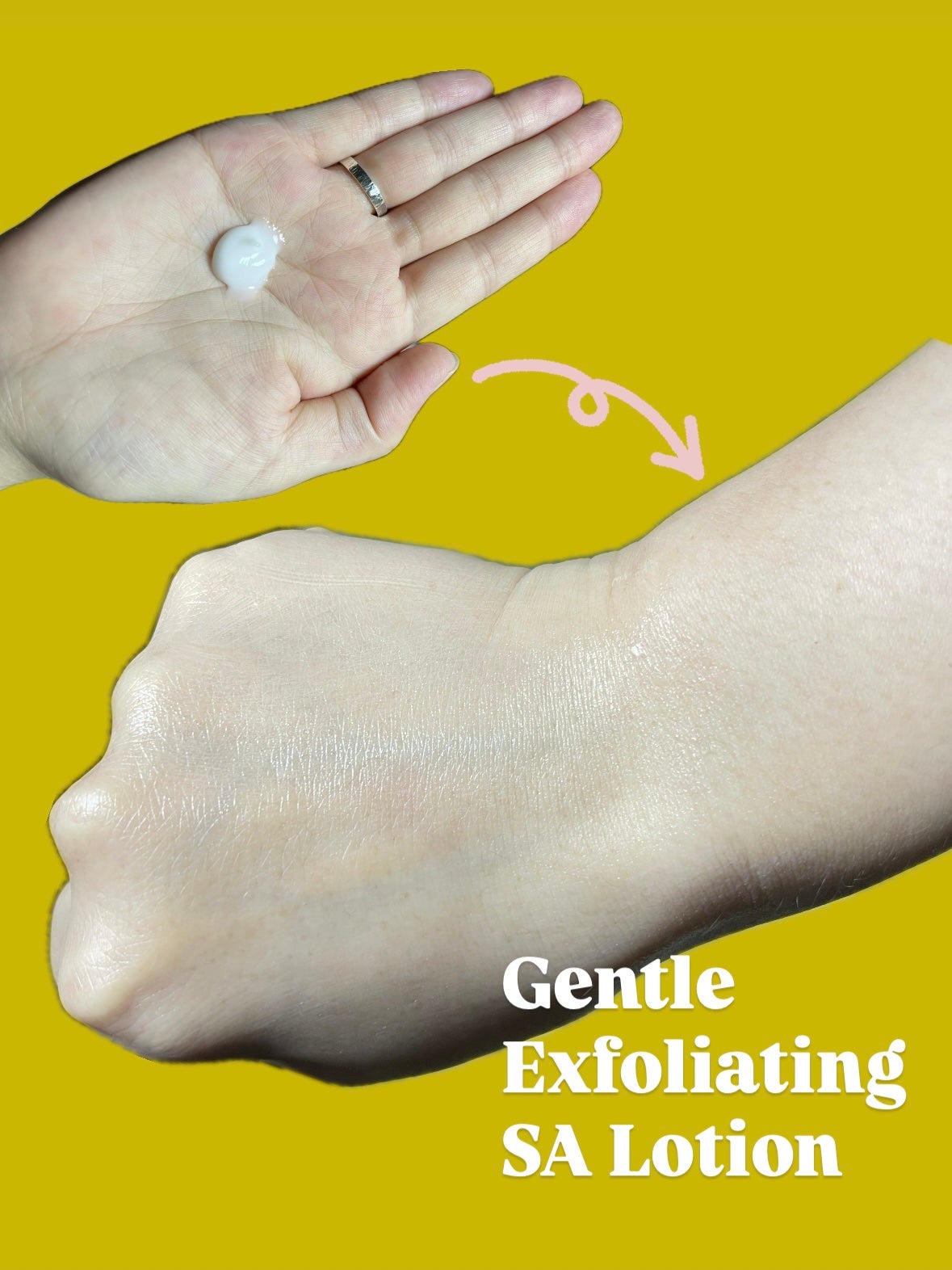 セタフィル ジェントルSAクレンザー/セタフィル/ピーリングを使ったクチコミ(3枚目)