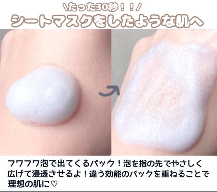 30秒クイックバブルマスク3種セット/MENOKIN/シートマスク・パックを使ったクチコミ(3枚目)