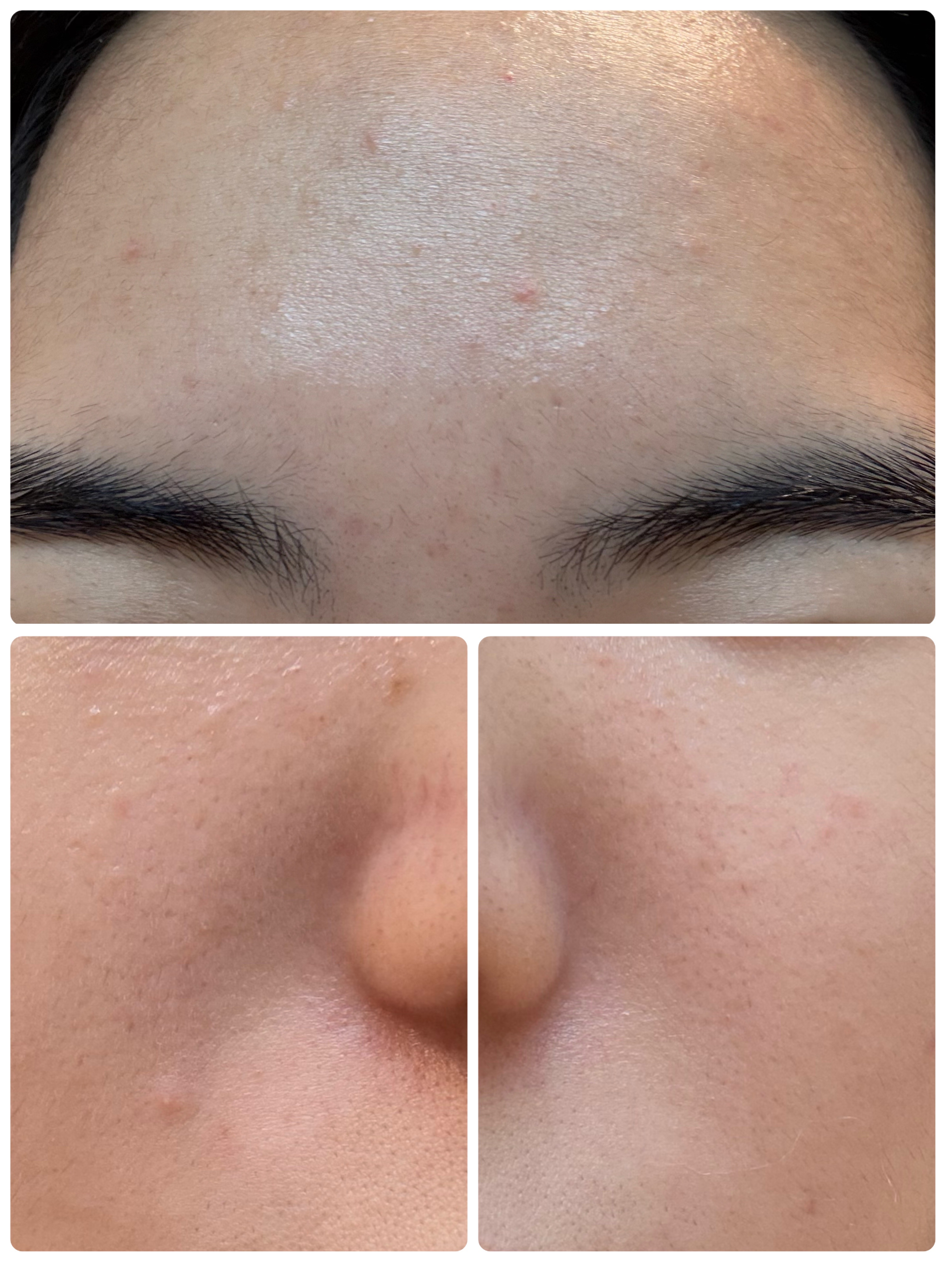 ブラックヘッドバームスクラブ/オブジェ/フェイスバームを使ったクチコミ（3枚目）