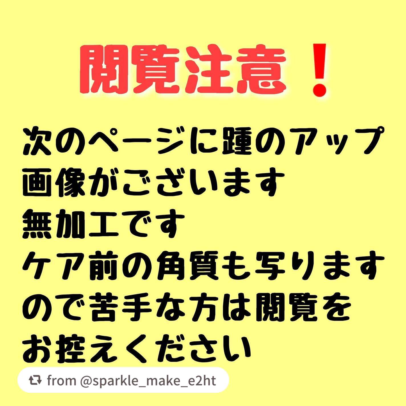 ナチュラルアクアジェル/Cure/ピーリングを使ったクチコミ(2枚目)